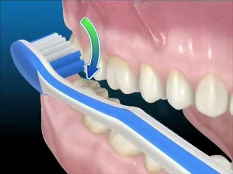 Consigli per una corretta tecnica di spazzolamento: ottimizza la tua igiene orale